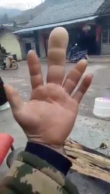 Рука Без Пальцев